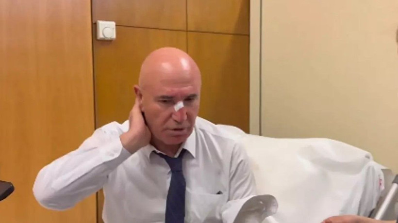 Meclis'teki yumruklu kavgada CHP'li Tanal'ın burnu kanadı! İlk müdahale revirde yapıldı - Resim: 4