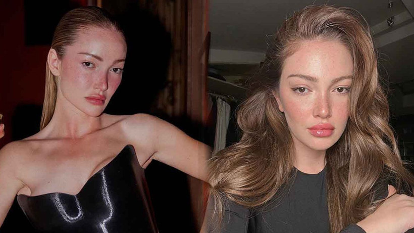 Danla Bilic apar topar ameliyata alınmıştı! İlk açıklama geldi - Fotoğraf: 6