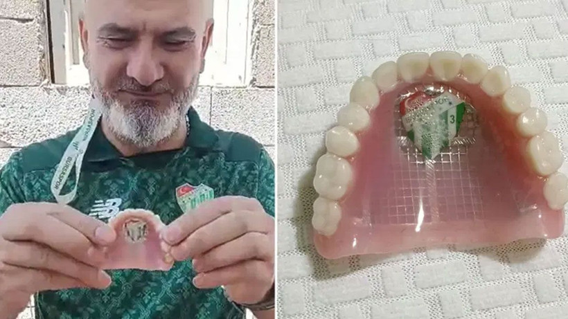 Görenler şoke oluyor, böyle taraftar görülmedi! Damağına Bursaspor arması yaptırdı - Fotoğraf: 4