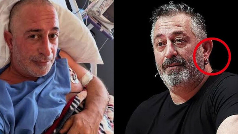 Cem Yılmaz'da dikkat çekti! Kulak memesindeki 'Frank' işareti ve anlamı... - Fotoğraf: 2