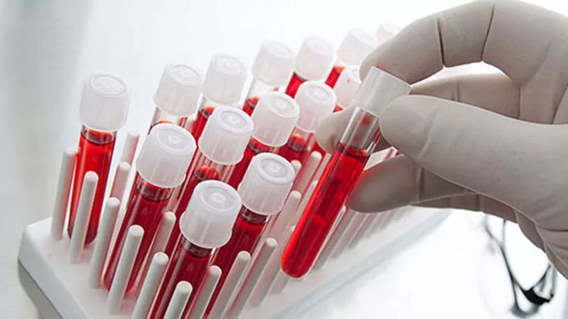 Kan grubunuzla ilgili bu detayı ilk kez duyacaksınız! A grubu olanlar dikkat! - Resim: 1