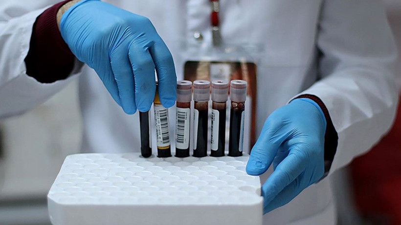 Kan grubunuzla ilgili bu detayı ilk kez duyacaksınız! A grubu olanlar dikkat! - Resim: 3