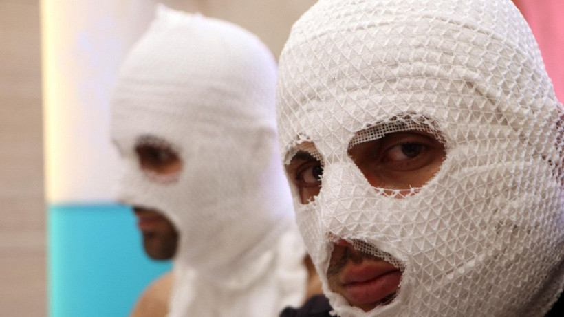 Erzurum'da çakmak doldururken hastanelik oldular - Resim: 1