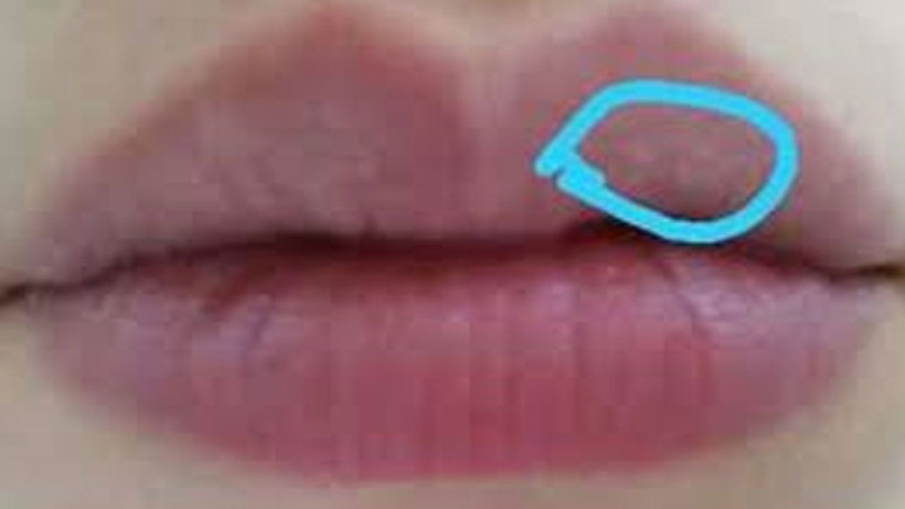 Dudaklarınızdaki bu görüntüye çok dikkat edin! Bakın nedeni neymiş - Resim: 2