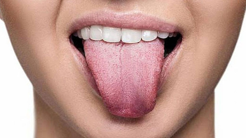 Dil rengi böyle olanlara kötü haber! Hemen aynaya bakın - Resim: 3