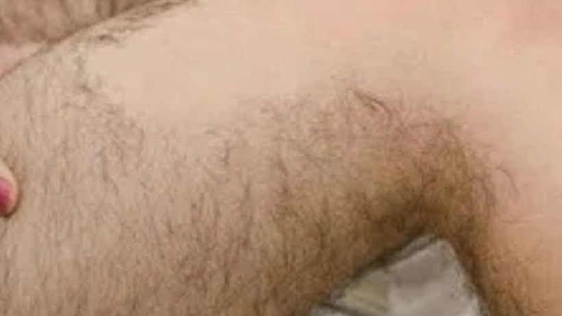 Kollardaki istenmeyen tüyleri yok ediyor. Anında etkili acısız doğal yöntem… - Resim: 4