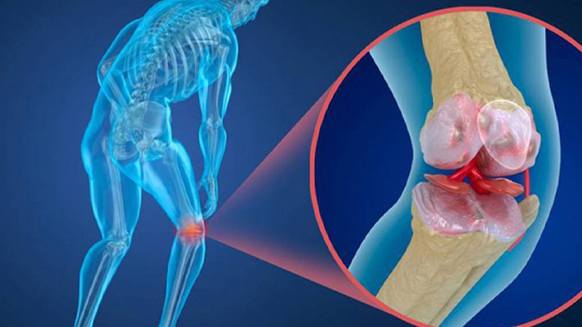 Yoğurdun içine 1 çay kaşığı koymanız yeterli; Vücudumuzdaki erimeyi hemen kesiyor - Resim: 2