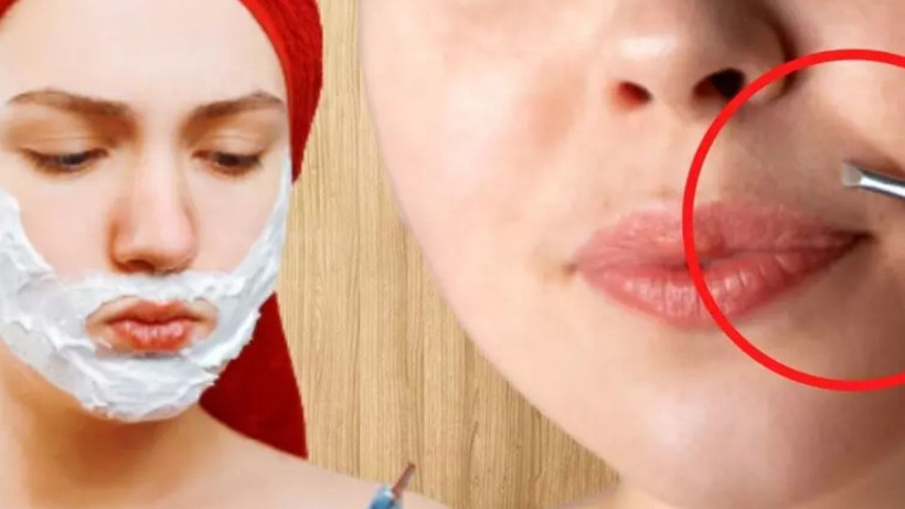 Yeniden çıkmıyorlar* Yüzdeki istenmeyen tüyleri doğal yollarla yok eden yöntem- iz kalmıyor - Resim: 2