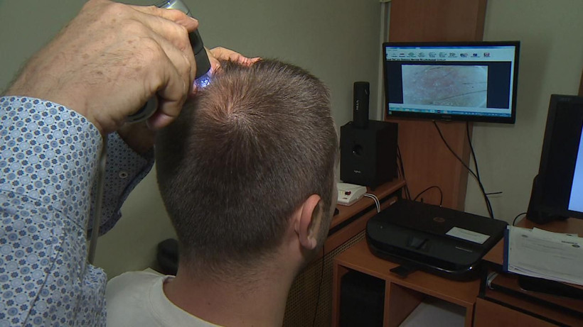 Saçı dökülenler mutlaka bu haberi okumalı; Tek bir damlası orman gibi yapıyor - Resim: 2