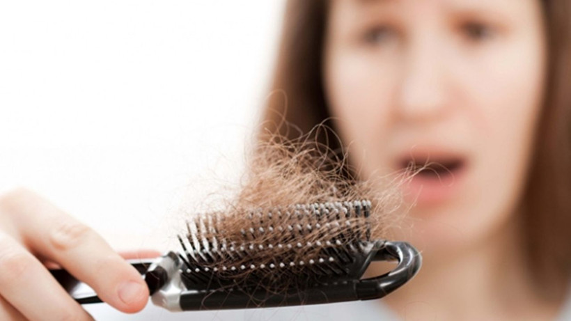 Saçı dökülenler mutlaka bu haberi okumalı; Tek bir damlası orman gibi yapıyor - Resim: 3