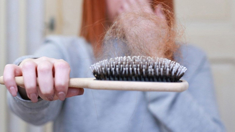 Saçı dökülenler mutlaka bu haberi okumalı; Tek bir damlası orman gibi yapıyor - Resim: 4