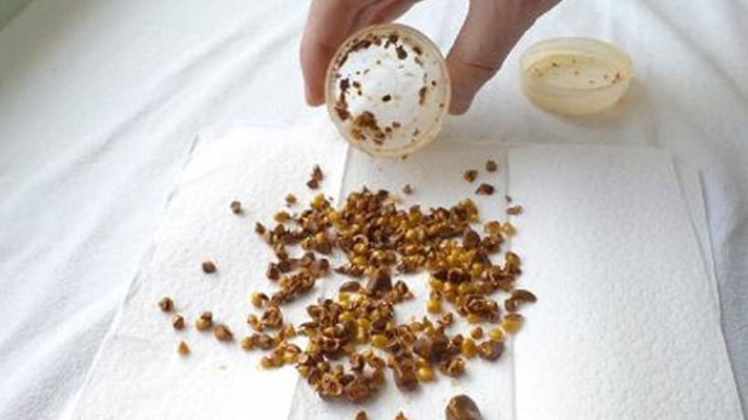 Böbrek taşı sancısı çekenler dikkat! 8 mm'den büyük taşları bile düşürüyor - Resim: 4