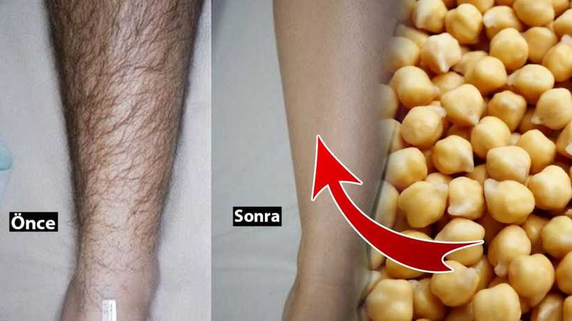 Tesadüfen keşfetti, istenmeyen tüylerine veda etti! Evde nohut varsa hemen bu kürü yapın. - Resim: 1