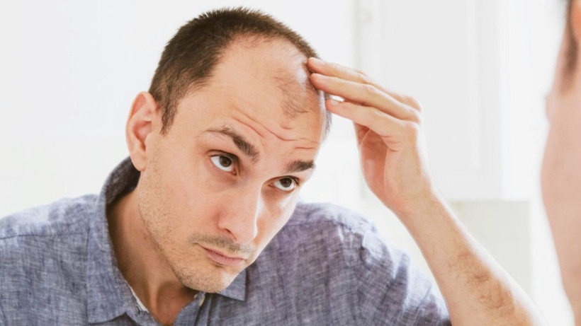 Saç dökülmesinin önlemenin 4 püf noktası- 1 tel bile asla dökülmüyor - Resim: 3