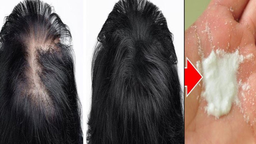 Saç dökülmesinin önlemenin 4 püf noktası- 1 tel bile asla dökülmüyor - Resim: 2