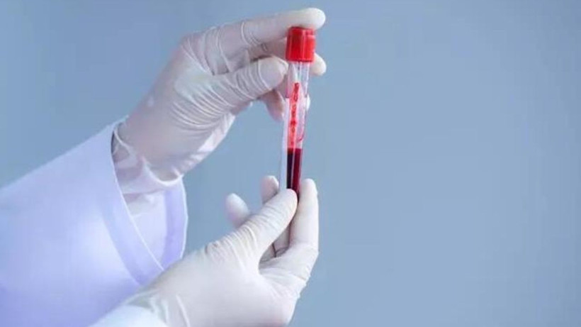 Araştırmalara göre en dirençli kan grubu açıklandı - Hastane yüzü görmüyorlar - Resim: 1