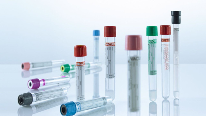 Araştırmalara göre en dirençli kan grubu açıklandı - Hastane yüzü görmüyorlar - Resim: 2