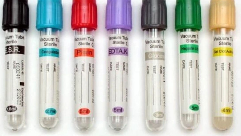 Araştırmalara göre en dirençli kan grubu açıklandı - Hastane yüzü görmüyorlar - Resim: 3