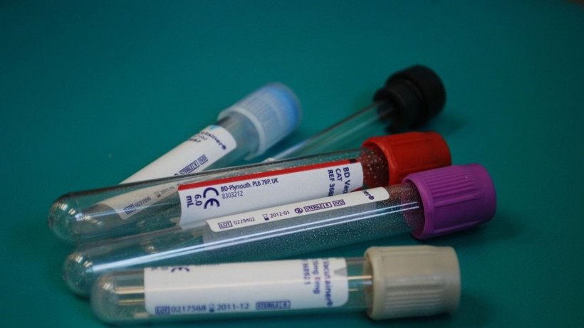 Araştırmalara göre en dirençli kan grubu açıklandı - Hastane yüzü görmüyorlar - Resim: 4