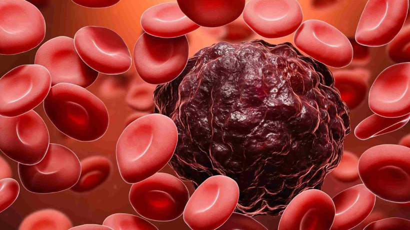 Bu kan grubuna sahip kişilerden zeka fışkırıyor; Araştırmalar ortaya çıkardı - Resim: 4