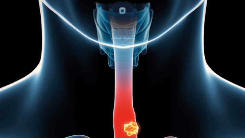 Yemek yedikten sonra hastaneye kaldırıldı; Doktorlar gördükleri karşısında şoke oldu... - Resim: 2