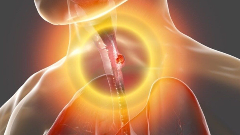 Yemek yedikten sonra hastaneye kaldırıldı; Doktorlar gördükleri karşısında şoke oldu... - Resim: 3