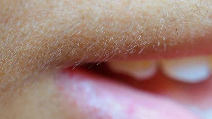 İstenmeyen tüyleri kökünden söküp alıyor; Osmanlı döneminde hamamlarda kullanılıyormuş - Resim: 3