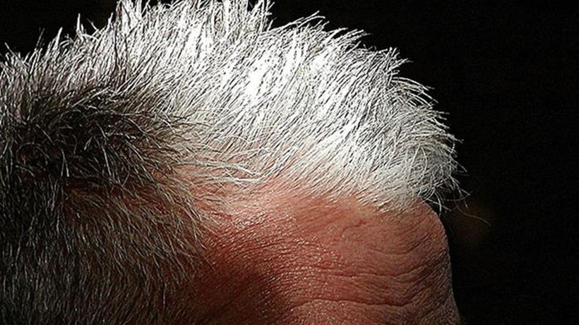 Beyazlayan saçlar için mucizevi yöntem; Bu bilgiyi mutlaka bir yere not alın - Resim: 1