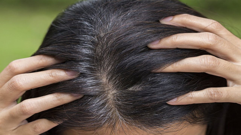 Beyazlayan saçlar için mucizevi yöntem; Bu bilgiyi mutlaka bir yere not alın - Resim: 3