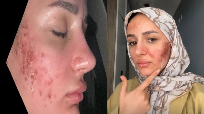 'Amin' videosuyla ünlenen fenomen Gizem Yıldız, anne ve babasına rest çekti! - Resim: 3