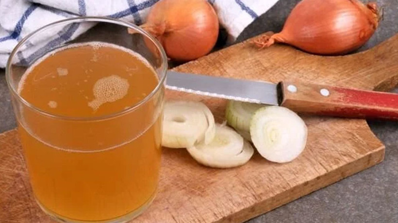 Sadece 15 dakikada saç çıkartıyor! Bu kürü yapmak çok kolay - Resim: 2