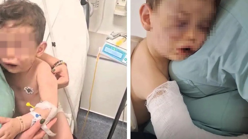 Denizli’de 2 yaşındaki Aren bebek dehşeti yaşadı: Yakıldı, ısırıldı, duvara çarpıldı… - Resim: 2
