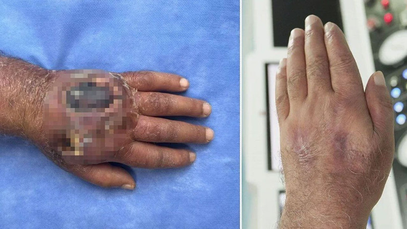 Hırsız öyle bir ısırdı ki; literatüre girmeye aday! - Resim: 1