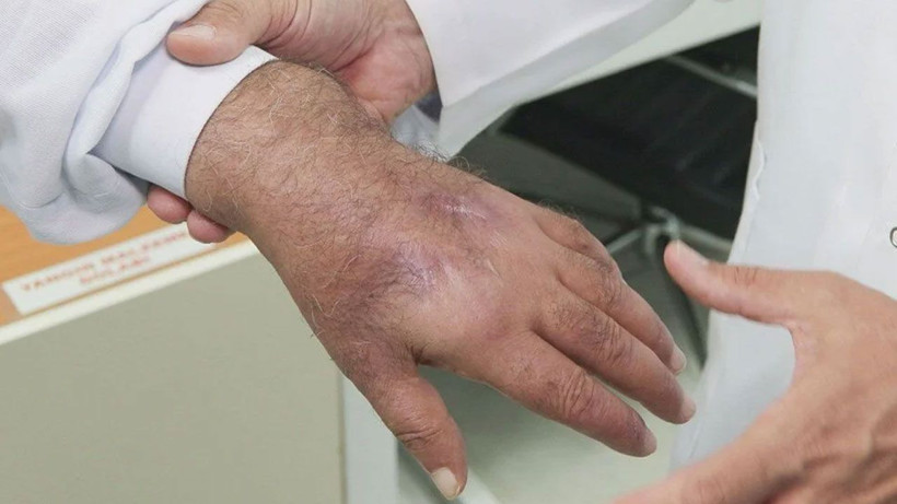 Hırsız öyle bir ısırdı ki; literatüre girmeye aday! - Resim: 2