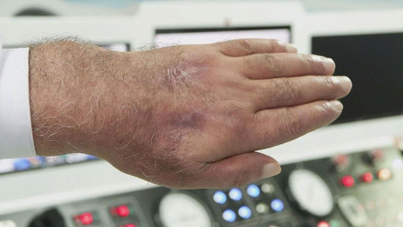 Hırsız öyle bir ısırdı ki; literatüre girmeye aday! - Resim: 3