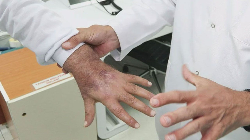 Hırsız öyle bir ısırdı ki; literatüre girmeye aday! - Resim: 4