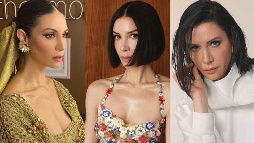 Ahu Yağtu’dan beyin anevrizması sonrası ilk paylaşım: “Toparlanıyorum” - Resim: 1