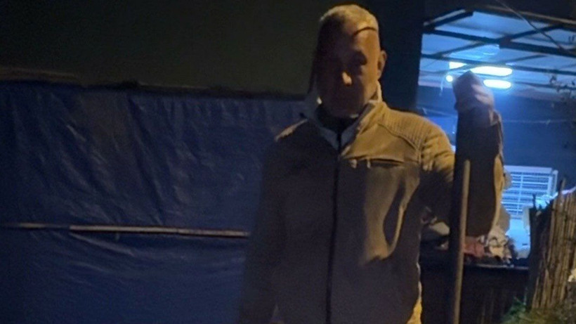 Elektrik akımına kapılan çocuk, komşusunun dikkati sayesinde kurtuldu - Resim: 3