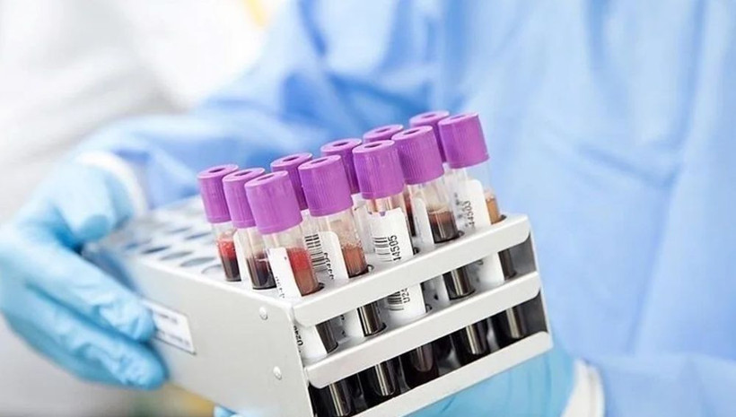 6 soruda maymun çiçeği virüsü hakkında merak edilenler: Belirtileri nedir? Evcil hayvana bulaşır mı? - Resim: 3