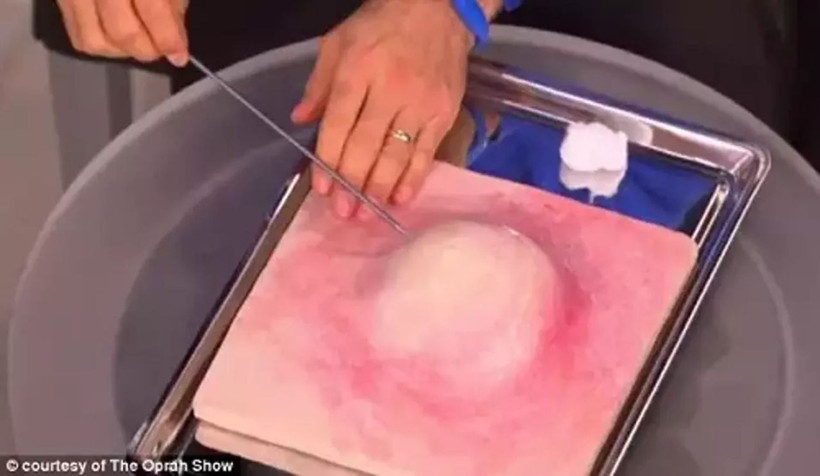 Dr. Mehmet Öz uyardı: Yüzünüzdeki “ölüm üçgeni”ni kurcalamayın! - Resim: 4