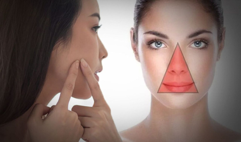 Dr. Mehmet Öz uyardı: Yüzünüzdeki “ölüm üçgeni”ni kurcalamayın! - Resim: 2