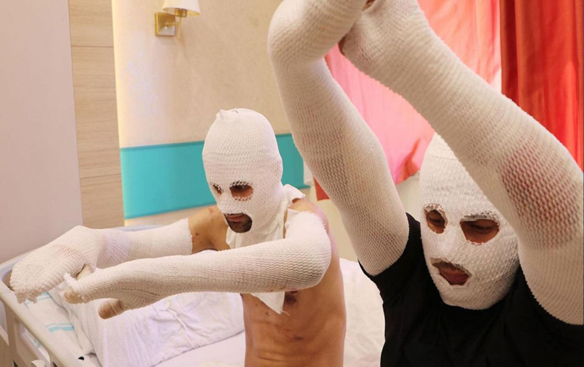 Erzurum'da çakmak doldururken hastanelik oldular - Resim: 4