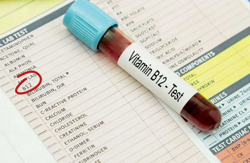 B12 içince vücudunuzda neler olur? Bu etkisini ilk kez duyacaksınız - Resim: 1