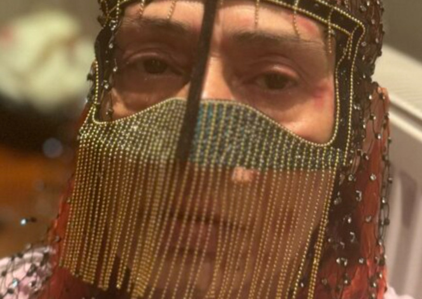 Yıldız Tilbe'nin yüzü yandı! Çareyi maske takmakta buldu - Fotoğraf: 5