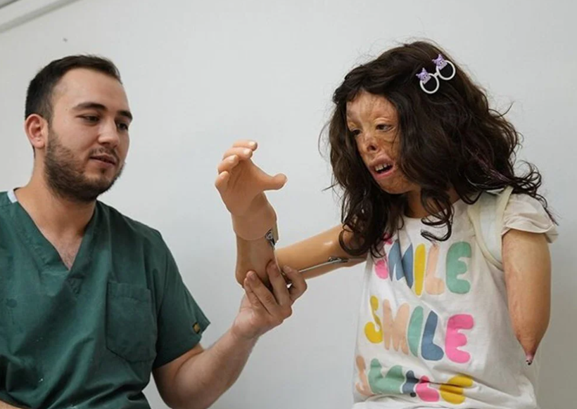 Her şeye meydan okuyor, ressam olmak istiyor! Protez koluna da kavuştu - Resim: 1