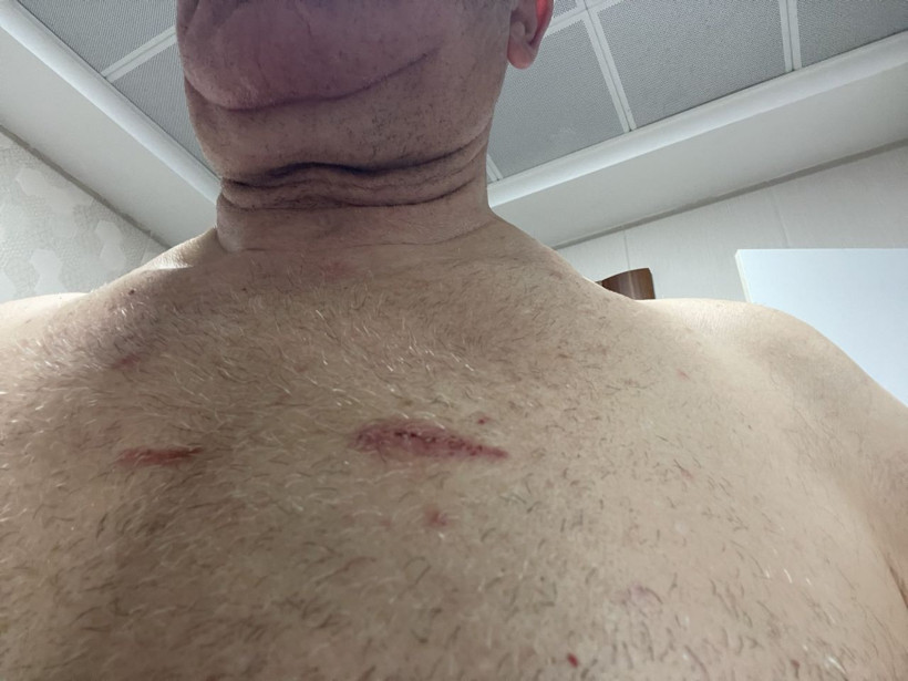 Mahmut Tanal vücudundaki darp izlerini paylaştı: “Hukuk devleti yaralandı” - Resim: 3