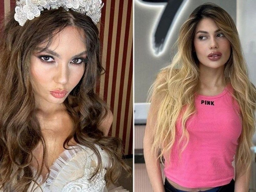 Nihal Candan'ın hastanedeki son hali ortaya çıktı! Meğer 29 kiloya kadar düşmüş - Resim: 4