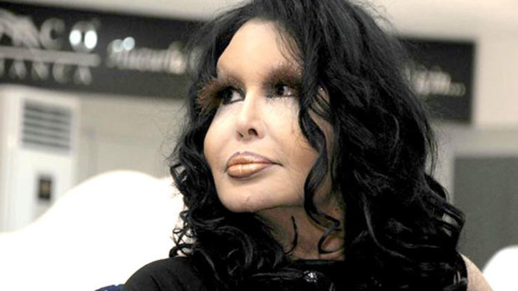 Bülent Ersoy hastaneye kaldırıldı! - Resim: 4